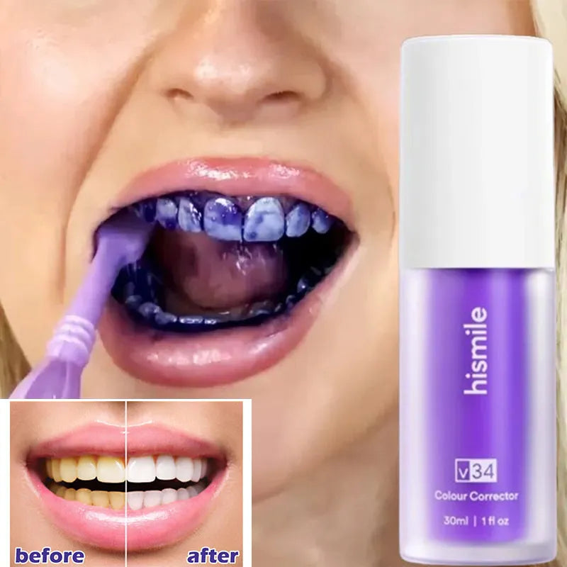 HISMILE V34 Toothpaste Whitening Teeth Repair Teeth White